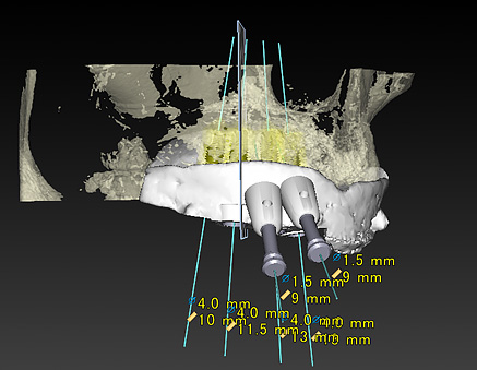 コンピュータガイドシステムの図