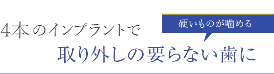 4本のインプラントで取り外しの要らない歯に